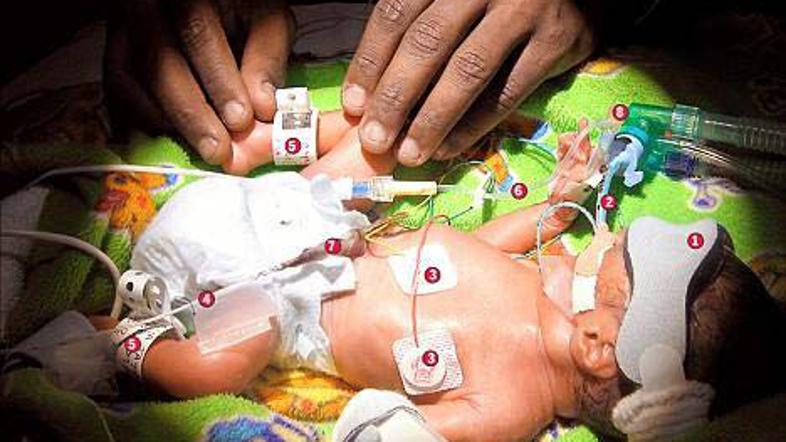 Mala Aya Jayne leži na intenzivnem oddelku, kjer naj bi lepo napredovala.