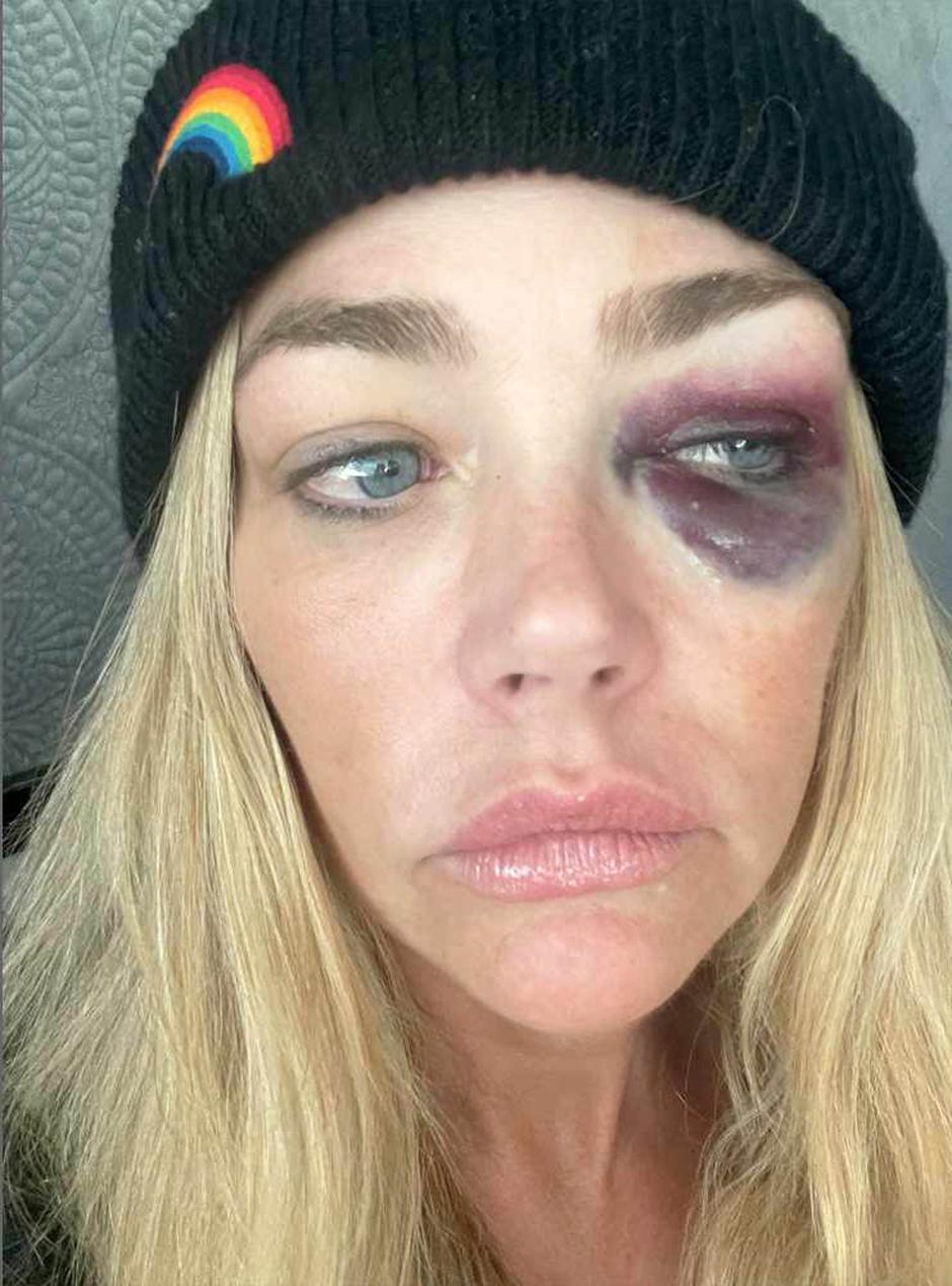 Denise Richardson | Avtor: 