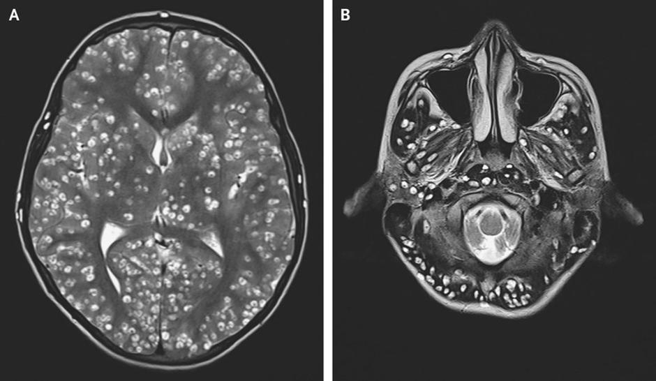  | Avtor: BMJ