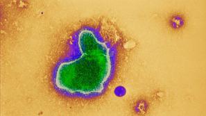 Respiratorni sincicijski virus