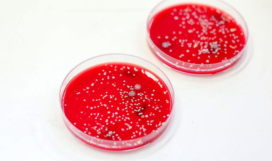 Bris mikroorganizmi | Avtor: Matija Habljak / PIXSELL