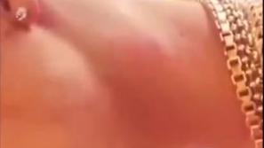 Justin Bieber, poškodba, vrat