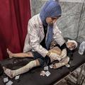 Gaza otrok bolnišnica