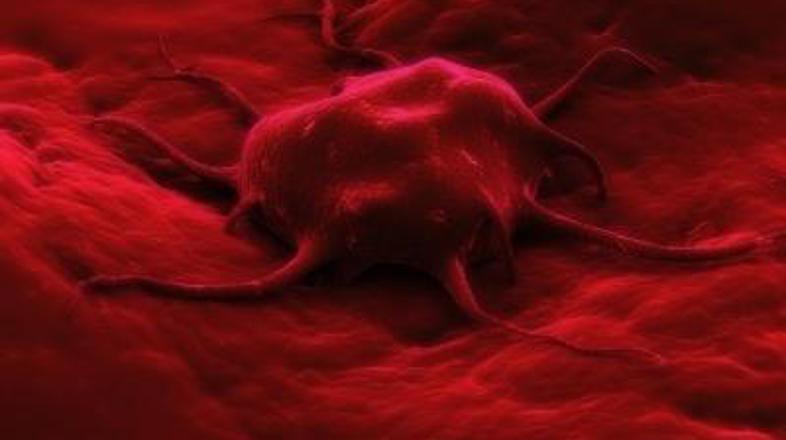 S prekomerno telesno težo povečujete možnost nastanka raka.