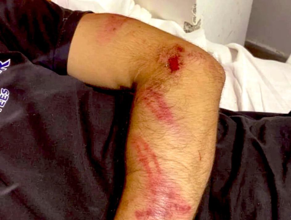 Posledice policijskega nasilja v Srbiji