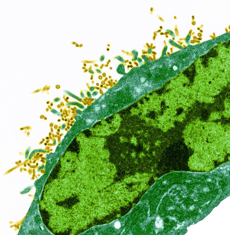 virus gripa | Avtor: Profimedia