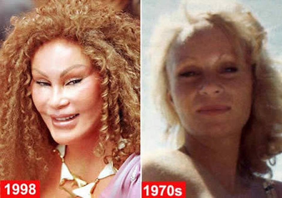 Jocelyn Wildenstein | Avtor: Žurnal24 main