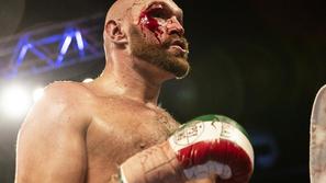 tyson fury