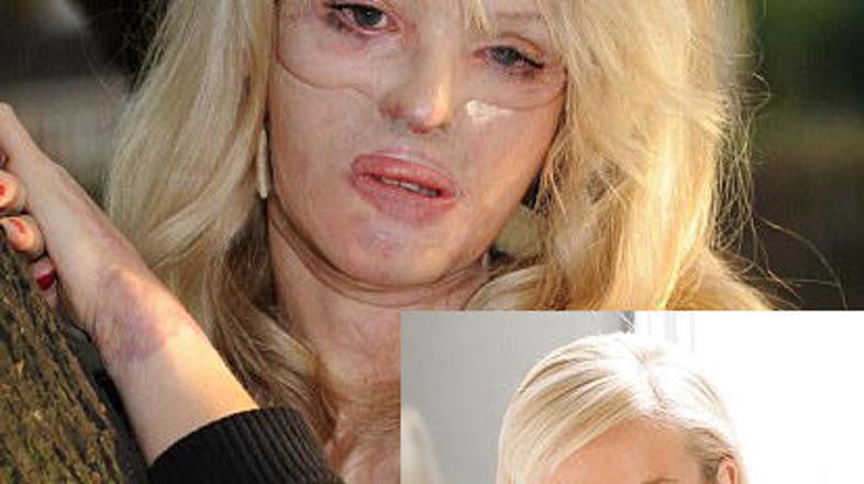 Katie danes in nekoč.