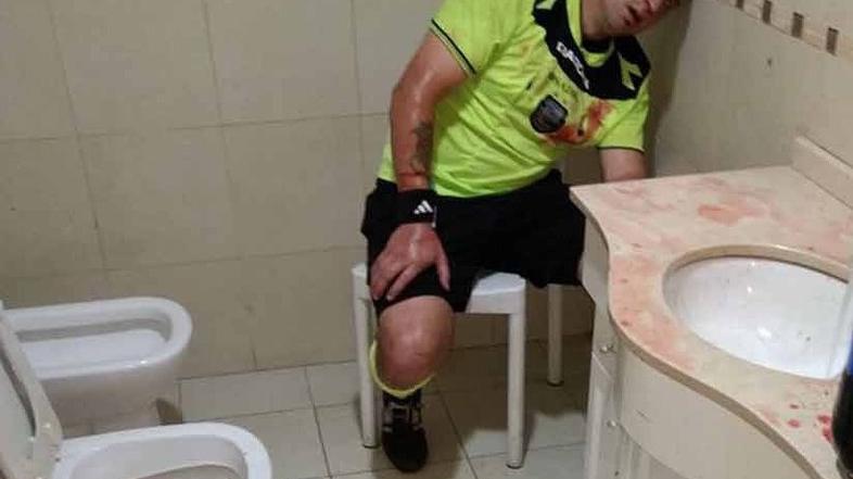 nogometni sodnik kri garderoba