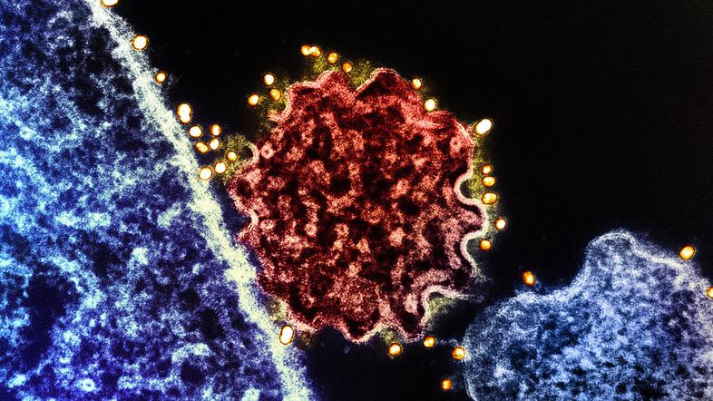 virus Nipah