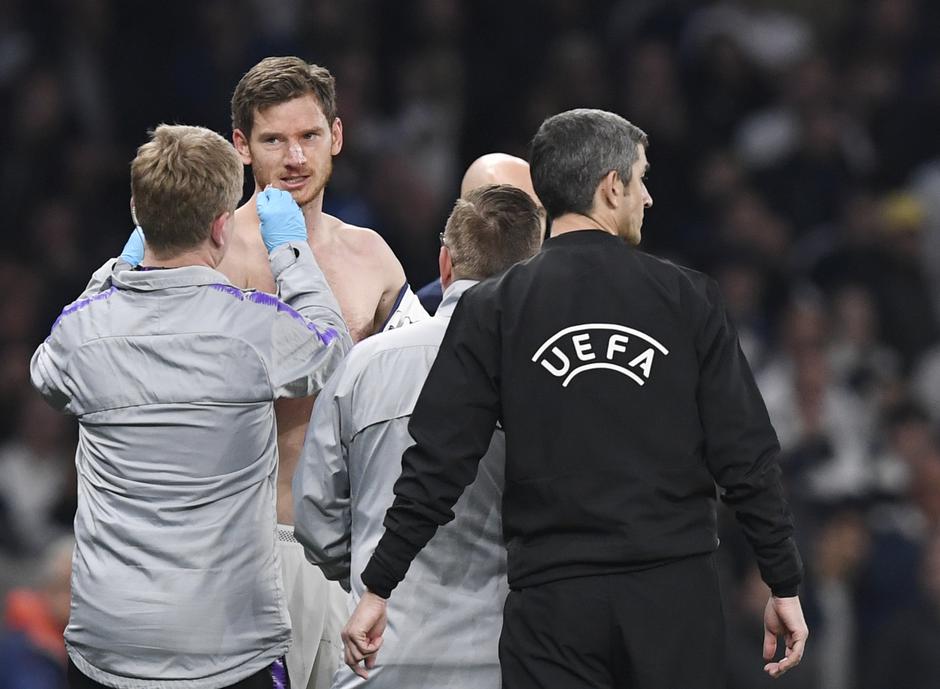 vertonghen | Avtor: Epa