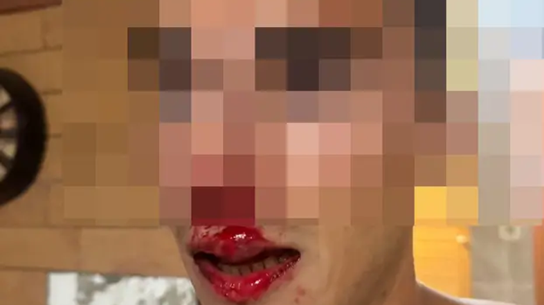 Pretep med varnostniki in Slovenci v Savudriji