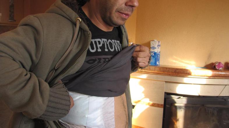 Veljan Kovačič, obstreljeni v včerajšnjem streljanju, nam je opisal dogajanje. (