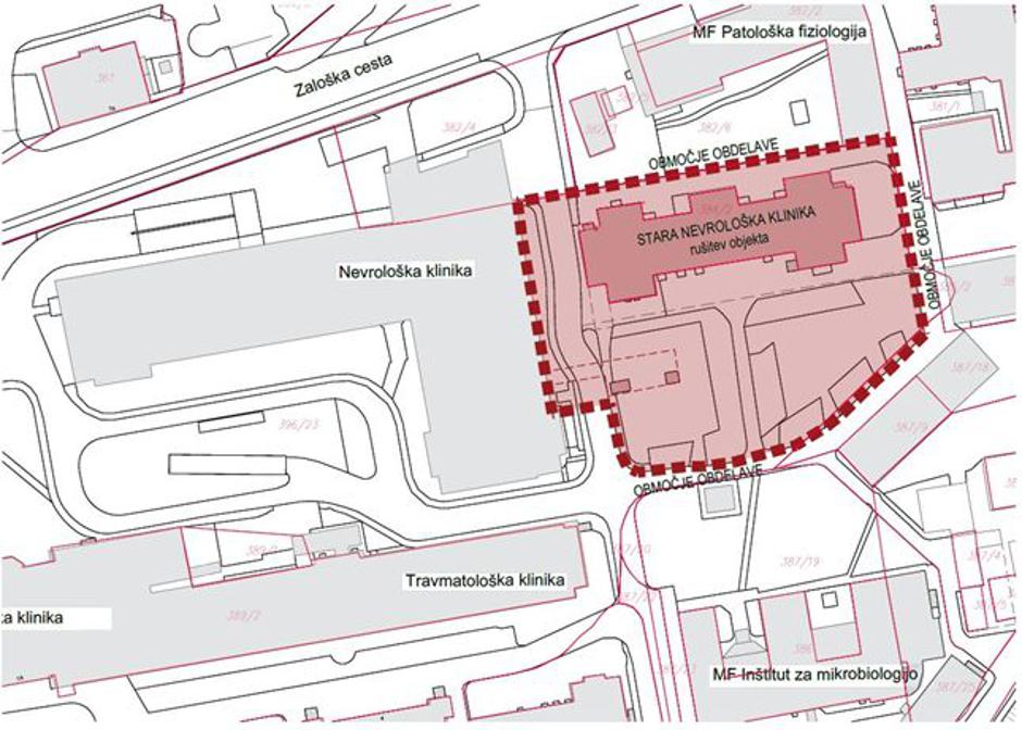Načrt: Nevrokirurška klinika del bo del načrtovanega kampusa Medicinske fakultete | Avtor: UKC LJ