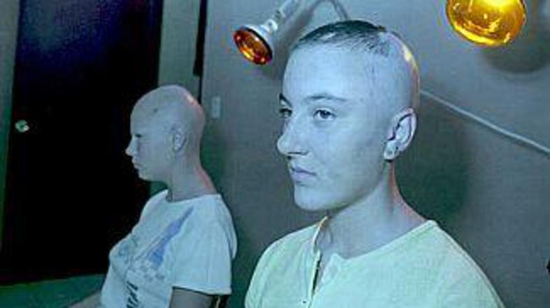 Žrtve černobilske katastrofe