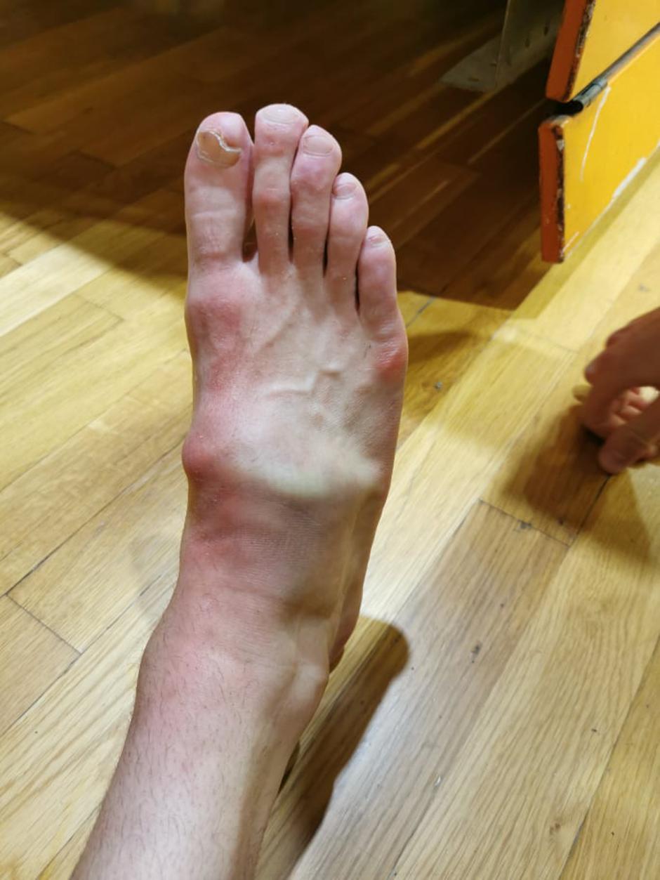 Matej Fideršek poškodba | Avtor: Facebook