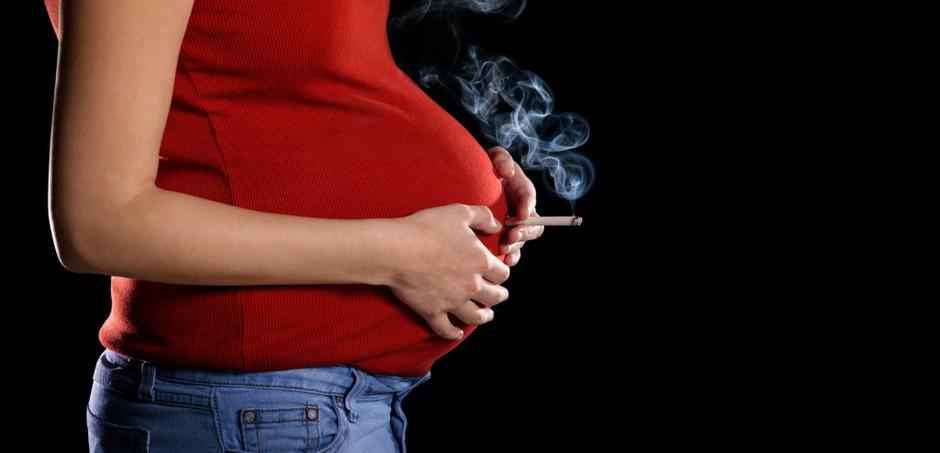 Kajenje med nosečnostjo | Avtor: Profimedias
