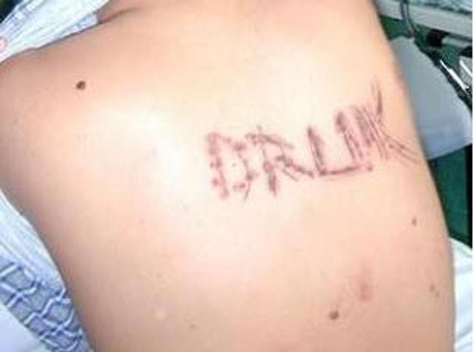 Fizična in psihična zloraba | Avtor: 24sata