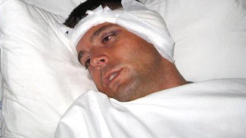 Berišiću so napadalci odgriznili uho.