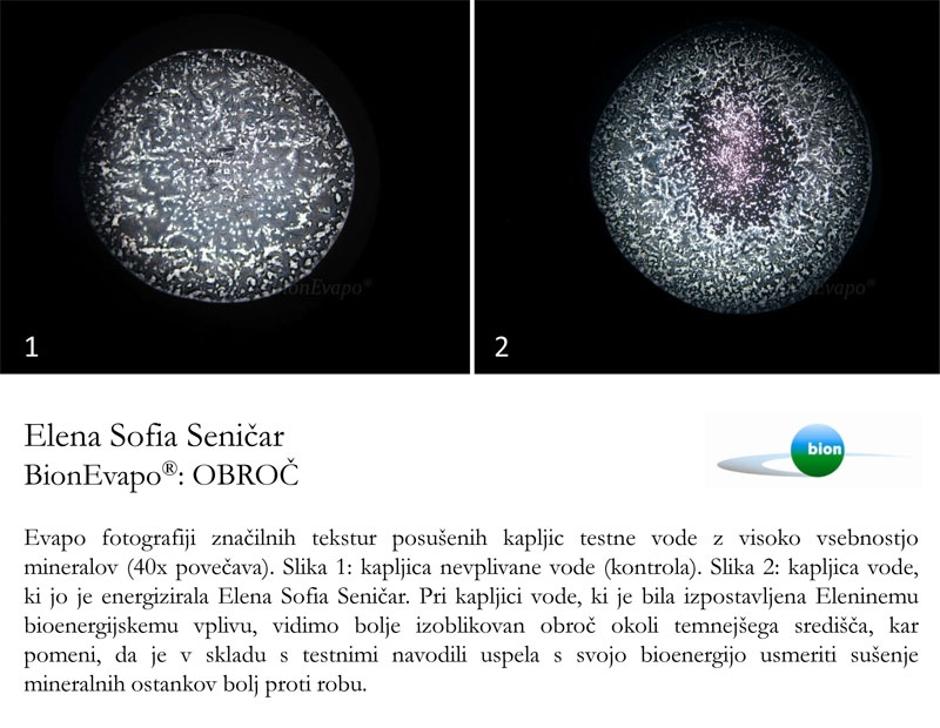 bion | Avtor: Žurnal24 main