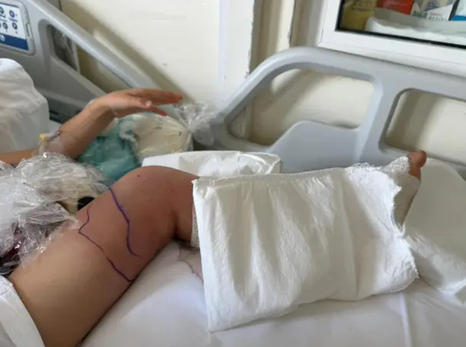 ugriz gad | Avtor: Profimedia