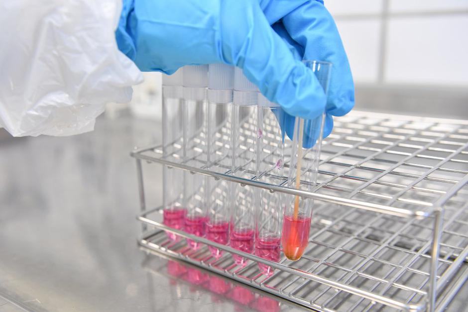 Ptičja gripa | Avtor: EPA