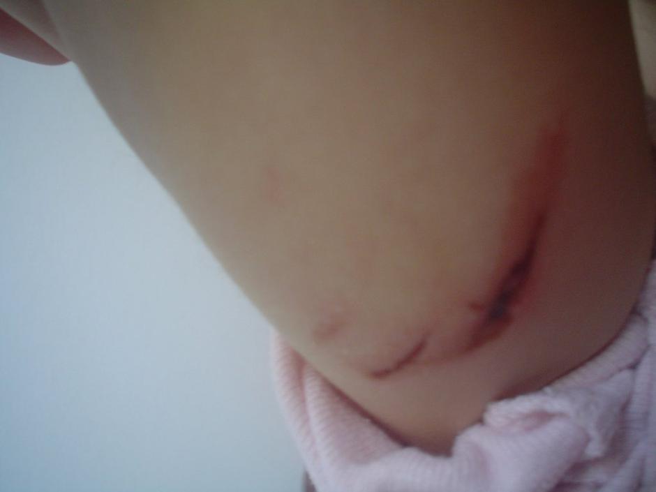 napad, pes, otrok, rana, roka | Avtor: Žurnal24 main