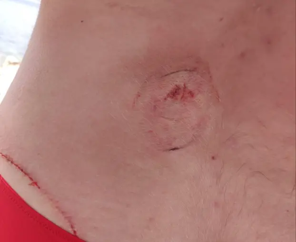 Ugriz želve na otoku Čiovo | Avtor: 24sata/bralec