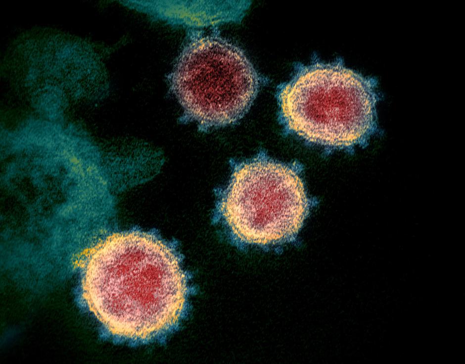 Koronavirus covid-19 laboratorij | Avtor: Profimedia