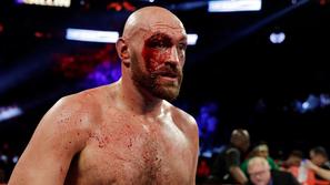 Tyson Fury
