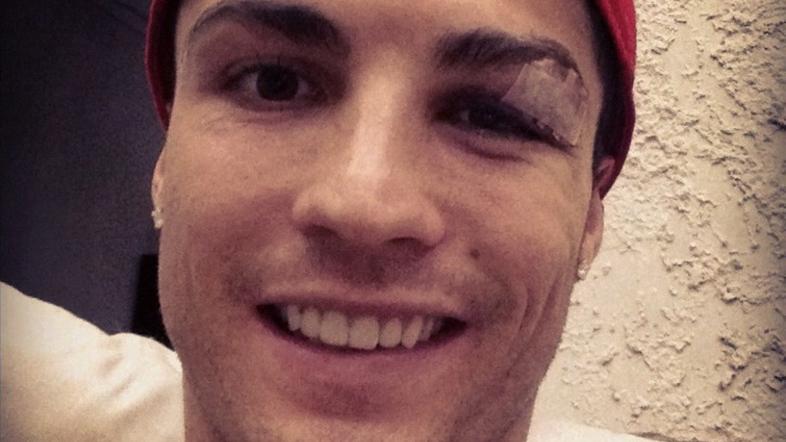 Ronaldo Navarro poškodba razbita arkada