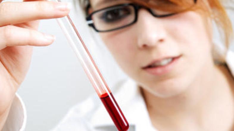 Sodelavec me je že dlje časa mešal ...