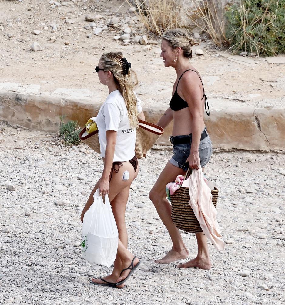 lila moss | Avtor: Profimedia