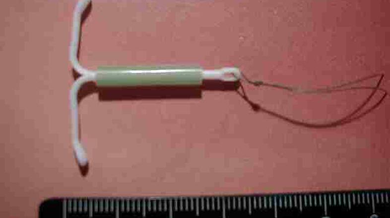 Ginekologi tovrstno zaščito priporočajo predvsem ženskam s stalnimi spolnimi par