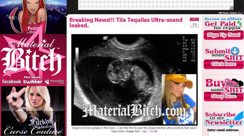 Spletni portal MaterialBitch zatrjuje, da je fotografija Tilina. (Foto: Material