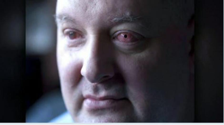 Zob za oko | Avtor: Žurnal24 main