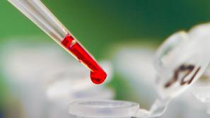 (Foto: Shutterstock)