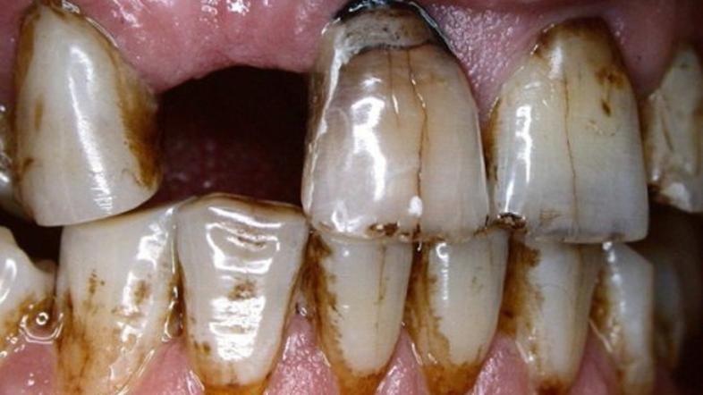 Ovitki zavojčkov cigaret