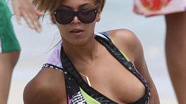 Kuku, bradavička je tu! (Foto: Pop Crunch)