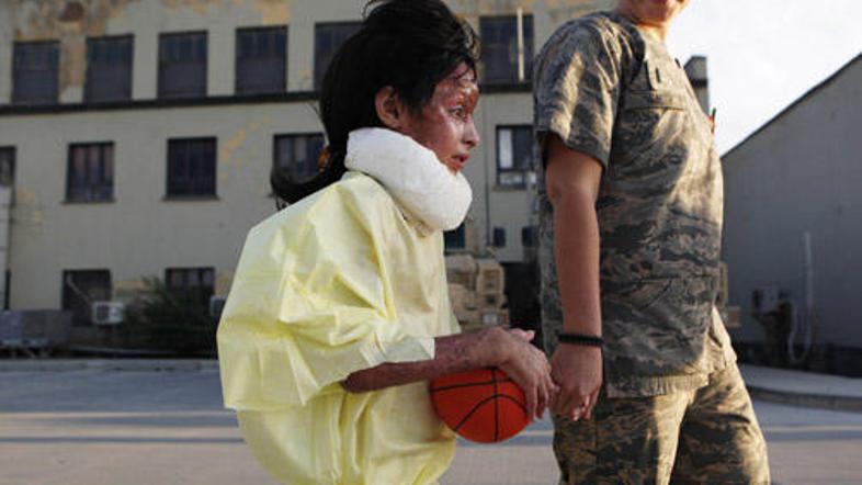 Deklica je prestala petnajst operacij, v nekaj dneh pa naj bi se vrnila domov.