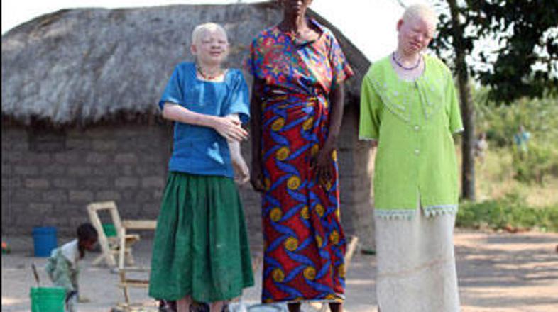 Verovanje v čarovništvo je v nekaterih delih Afrike še vedno močno prisotno.