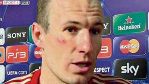 Arjen Robben 