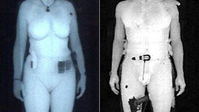 Prijela me je za prsi in vprašala 'Kaj je to?' Pojasnila sem, da imam protezo za