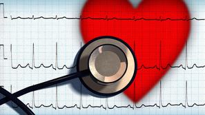 (Foto: Shutterstock)