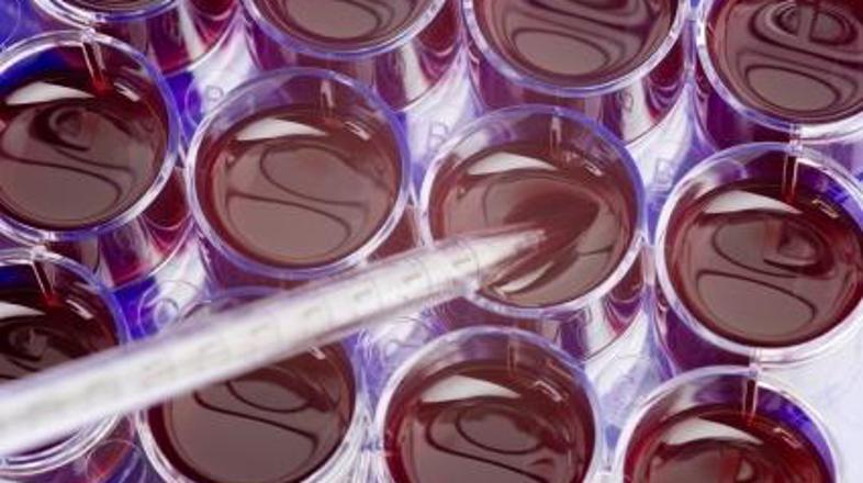 Kakršnokoli bančništvo je donosen posel.