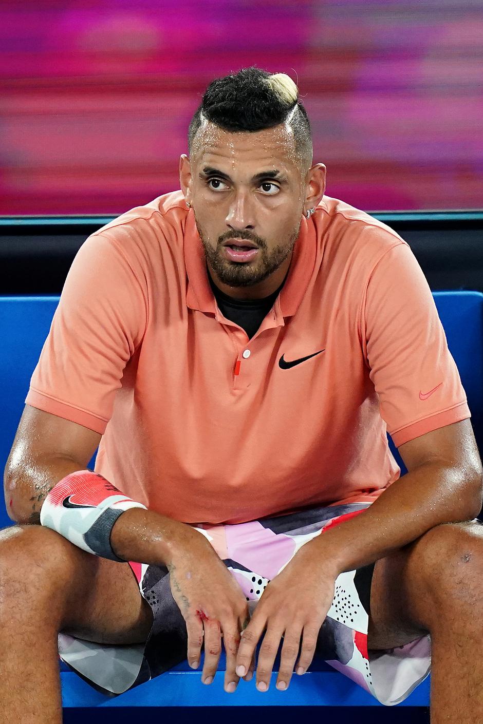 nick kyrgios | Avtor: Epa