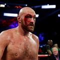 Tyson Fury