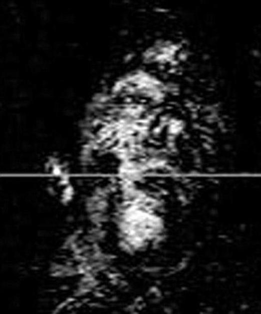 Fotografija ene izmed napadalk. (Foto: Daily Mail)