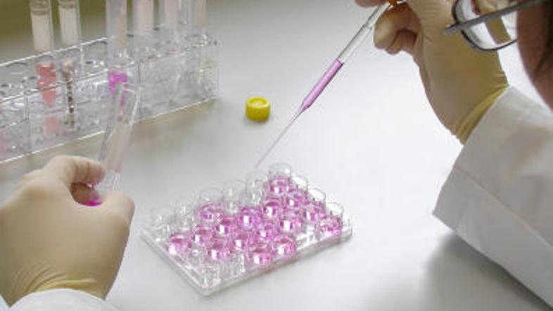 Cena samoplačniškega postopka umetne oploditve je okoli tisoč evrov. (Foto:) Ist